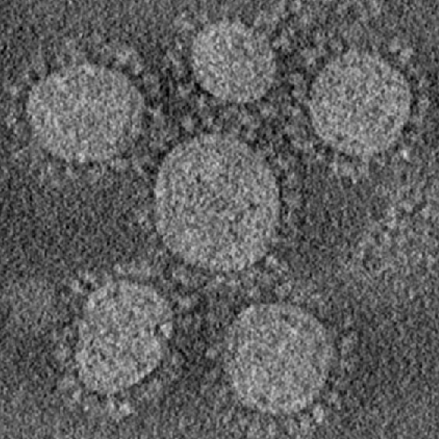 Coronaviridae: virion EM